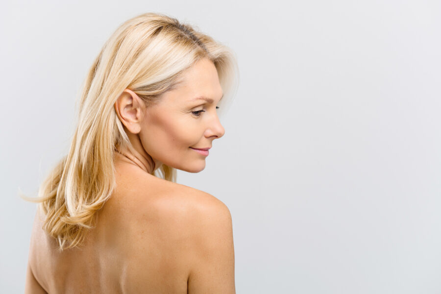 Woman looking over her shoulder after acne treatment in Hobart